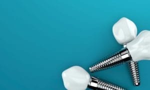 affordable dental implants in cary, north carolina