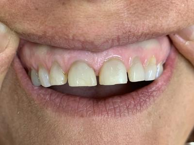 before dental care