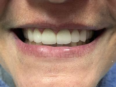 after dental care