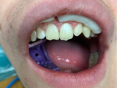 before dental care