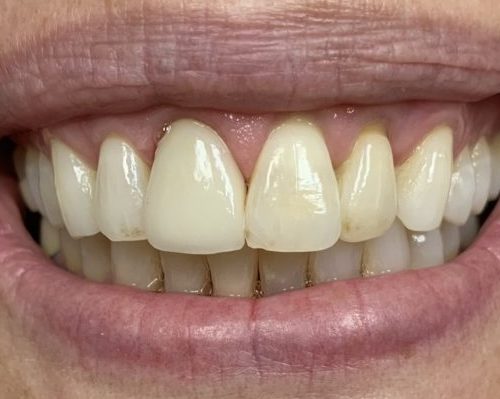 IMG-8405-scaled-e1663850875817-500x399