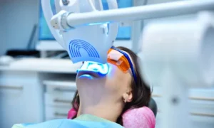 Brightening Your Smile with Professional Teeth Whitening in Cary, NC